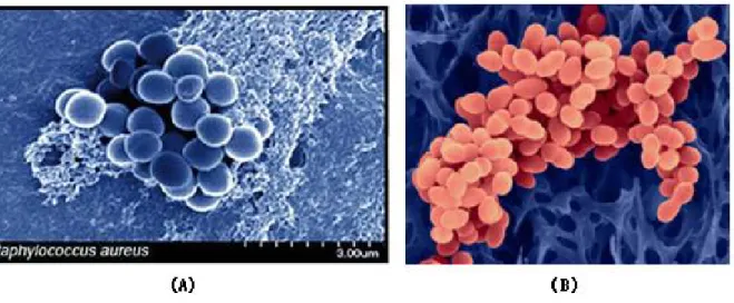 Figure 9 : Staphylococcus aureus [49, 50]. 