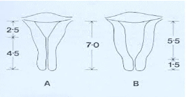 Figure 9 : Caractéristiques comparées des utérus de la nullipare et de la multipare [10] 