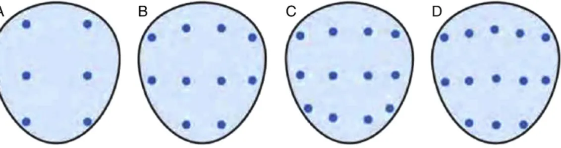 Figure 7. Représentation schématique de différents schémas de biopsie. (A)- Biopsie sextant [49] (B)  - Biopsie à 10 cœurs [55] (C)- Biopsie à 12 cœurs ou double sextant [53] (D)- Biopsie à 13 cœurs [52] 