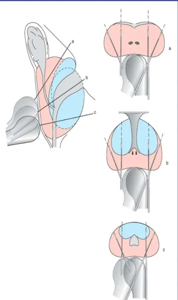 Figure 10. Schéma de 12 biopsies placées  sous contrôle échographique en coupes  prostatiques frontales obliques ou transverses  obtenues avec une sonde dont le faisceau est  dans l’axe de la sonde, au tiers supérieur, à la  base (a), au tiers moyen, au mi