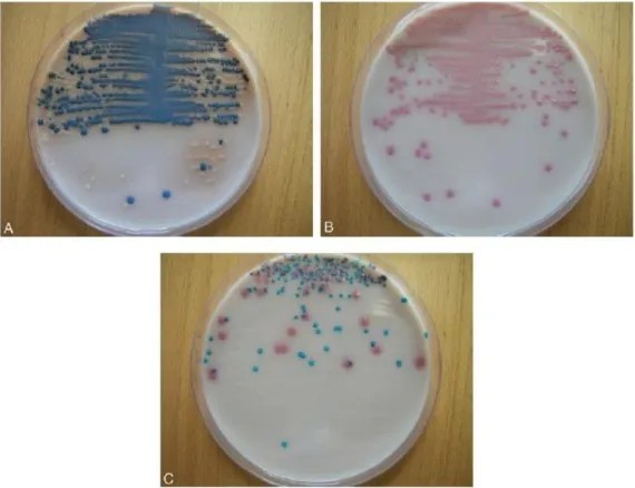 Figure 7: Exemples d'uroculture quantitative sur milieu chromogène.[20] 
