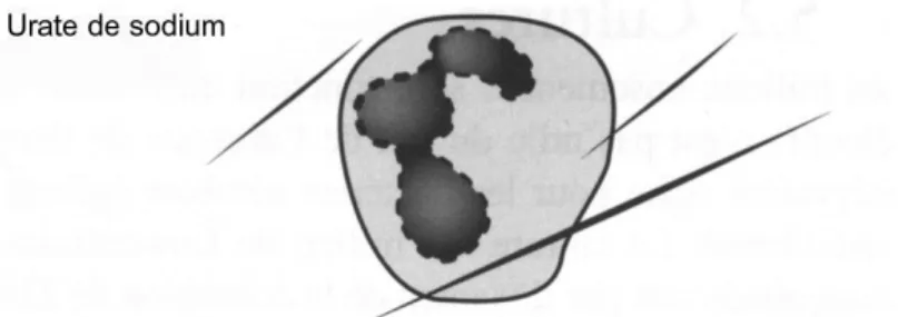 Figure 9: Cristaux d’urate de sodium[27] 