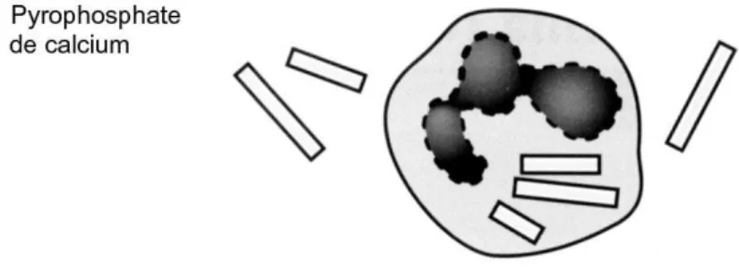 Figure 10: Cristaux pyrophosphate de calcium [27] 