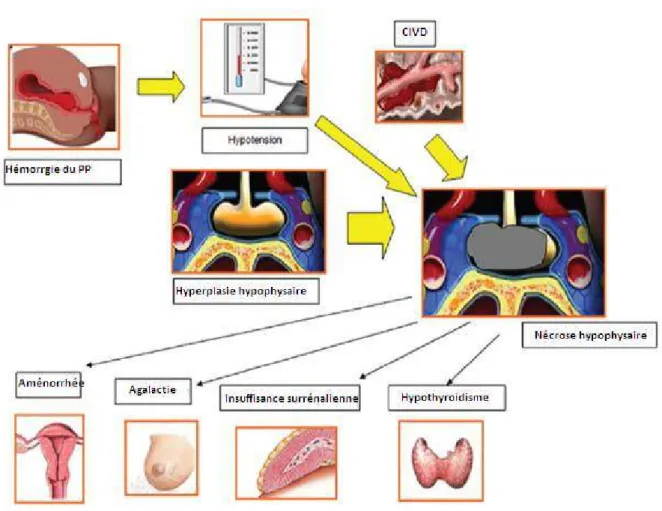 Figure 8: Schéma simplifié de la physiopathologie du Syndrome de Sheehan [133] 