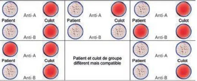 FIGURE 6 : Réactions compatibles: Transfusions non iso groupes possibles 