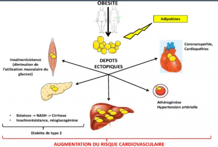 Figure 5 : Dépôts ectopiques du tissu adipeux avec les comorbidités (16) 