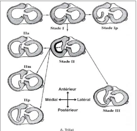 Figure 10: Classification de TRILLAT 