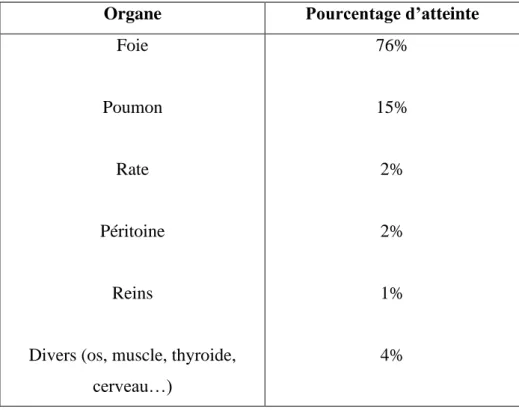 Tableau 1 : Principales localisations du kyste hydatique. 