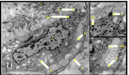Figure 3  : Cellules de Merkel en microscopie électronique  [ 9 ] 