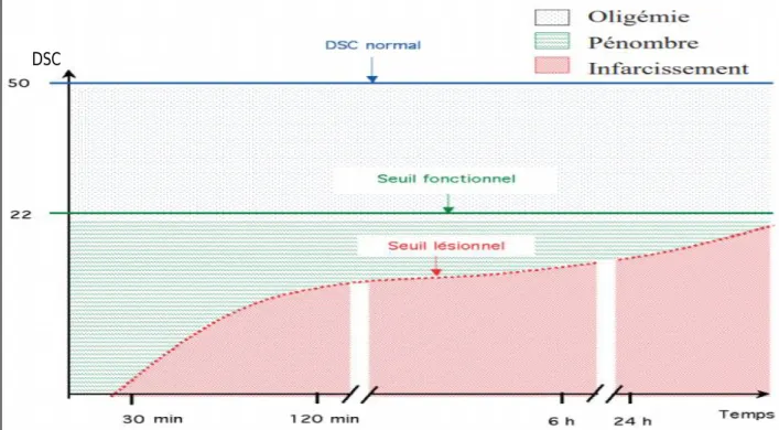 Figure 5 : La pénombre ischémique 