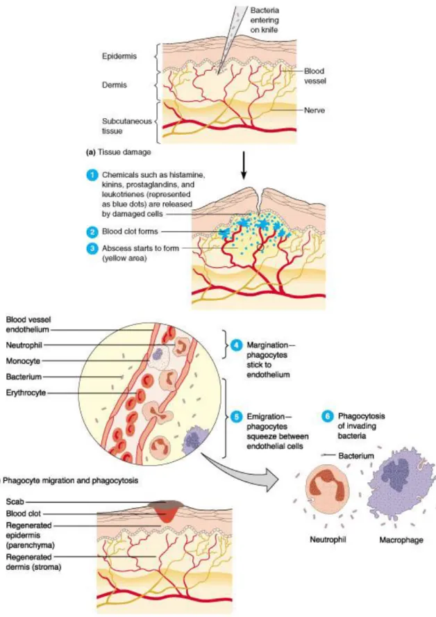 Figure 2 : Les phases de l‟inflammation 