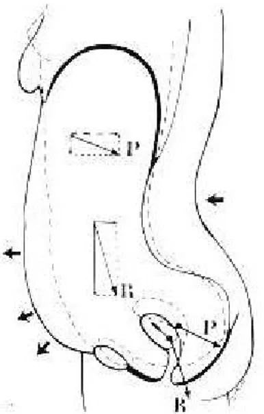 Figure 8 : résultante des forces de pression abdominale : modèle de Kamina [17] :   Direction de la résultante des forces chez la femme jeune (P) et âgée (R), chez qui la  cyphose dorsale et l’hyperlordose lombaire se sont accentuées sous l’effet du relâch