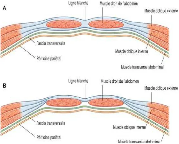 Figure 1 : Coupes transversales dans la paroi abdominale ventrale à mi distance  entre l’ombilic et la symphyse pubienne [1] 