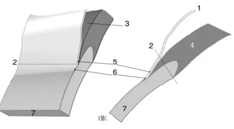 Figure 4: Anatomie chirurgicale de l’AIC : principaux repères. 