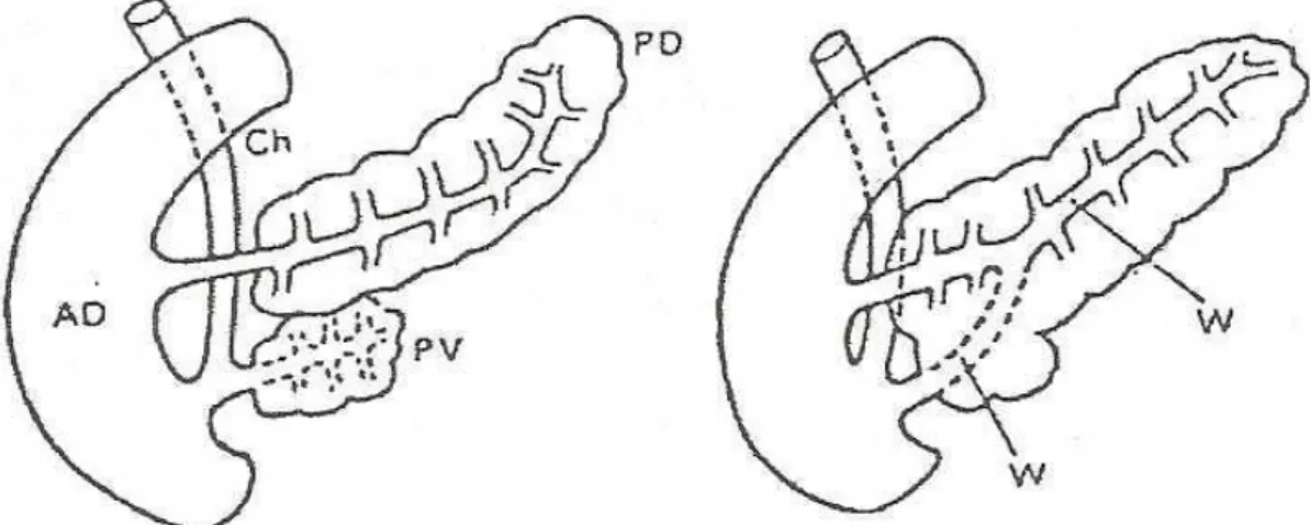 Figure 8 : fusion des bourgeons pancréatiques ventral et dorsal   avec formation du canal du Wirsung 