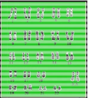 Figure 5 : caryotype féminin [4] 