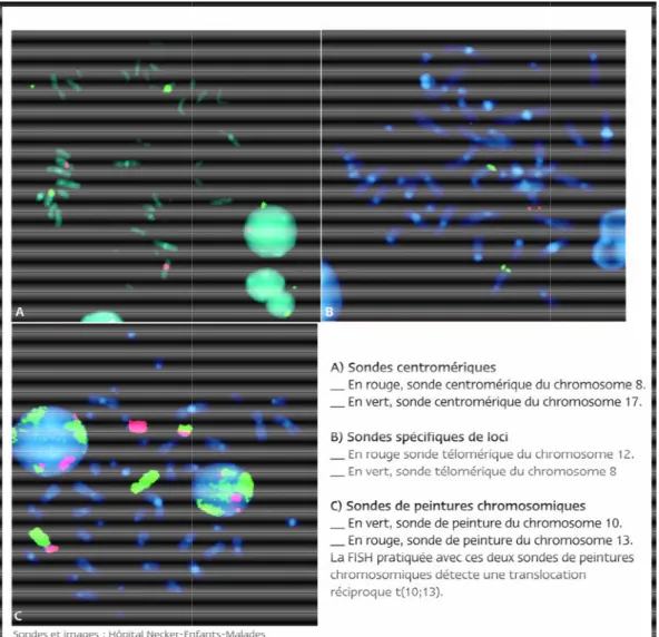 Figure 9 : Les sondes  1.3. La multifluorescence : 
