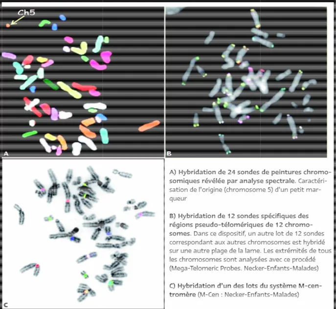 Figure 10: La multifluorescence 