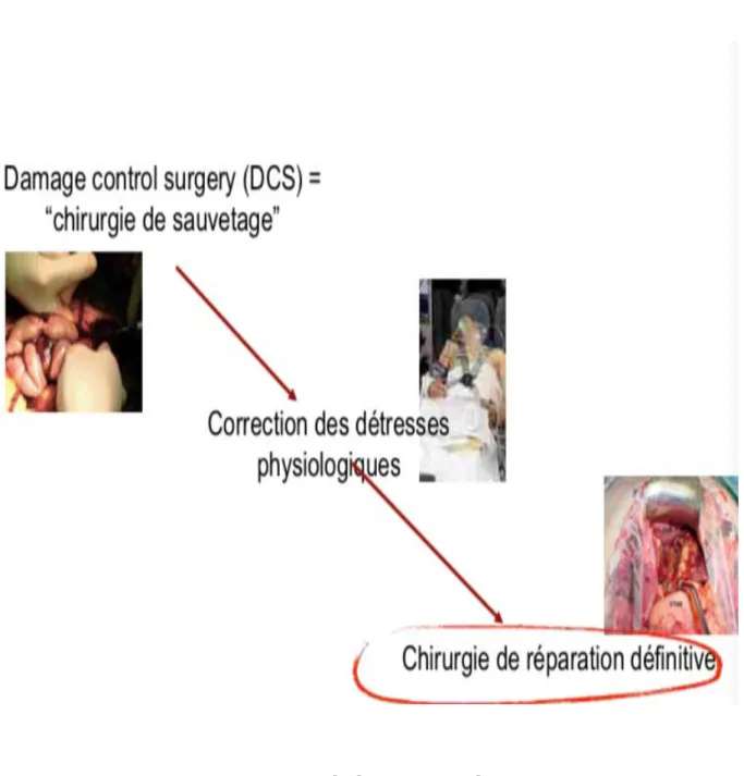 Figure 5:  le damage control 