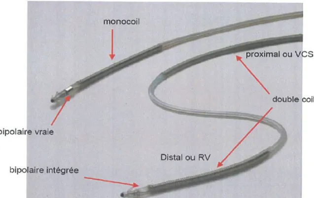 Figure 1 : Exemple de sondes de défibrillation  2. Fonctionnement général 