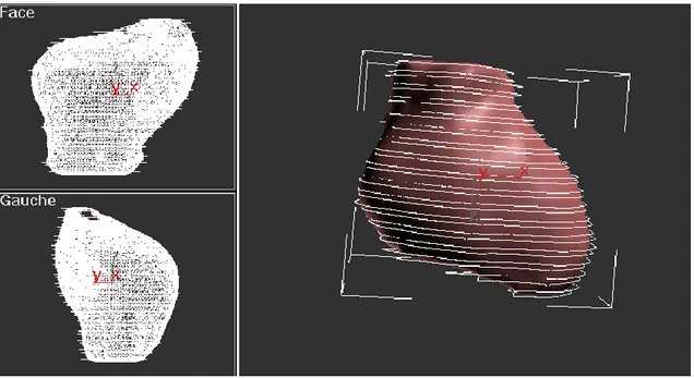 Figure 12.  Reconstruction 3D du cœur à l’aide de la méthode du marching cube 