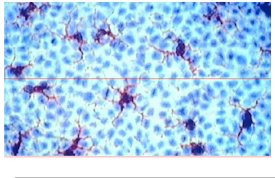 Figure 2. Immunomarquage par CD1a des cellules de langerhans sur un  feuillet épidermique de peau humaine 