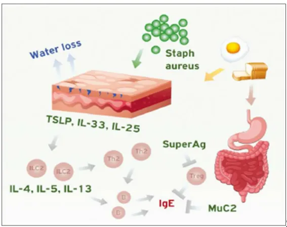 Figure 13: la physiopathologie de la DA et AA 