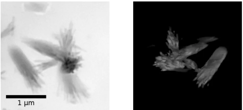 Figure 1.5: Soft X-ray microscopy transmission image of a hydrated cement paste (CEM-I, 