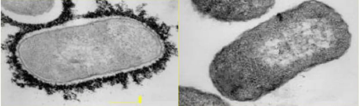 Figure 3: Image microscopique d’une bactérie encapsulée (à gauche), non encapsulée (à  droite)(11) 