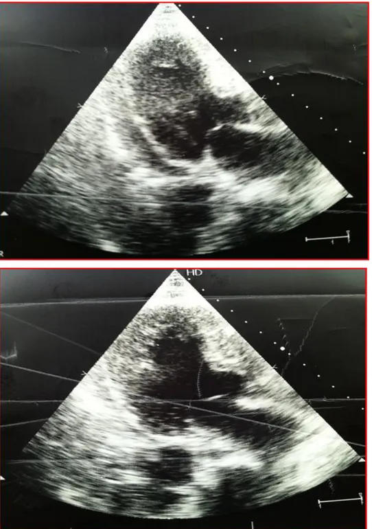 Figure 4 : Images: Echographie cardiaque transthoracique 