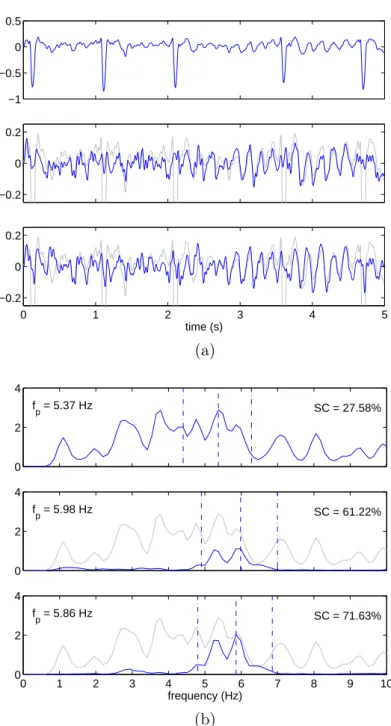 Figure 4.1: Atrial activity extraction in atrial fibrillation ECGs [P4, P26]. (a) Time courses
