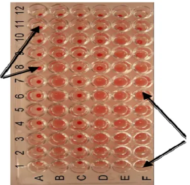 Figure 10 : Exemple de plaque de réaction d’agglutination       A8 a A11 montres des points donc réactions négatives