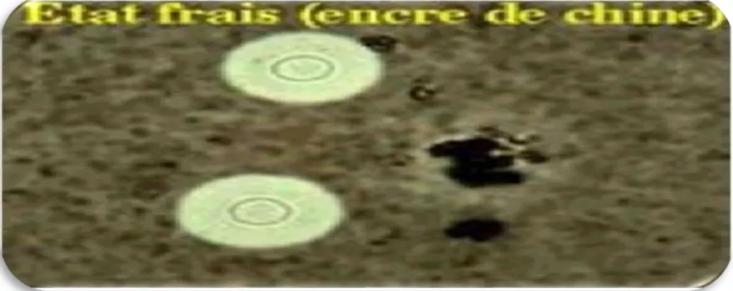 Figure 3 : Capsule a l’état frais  [6] 
