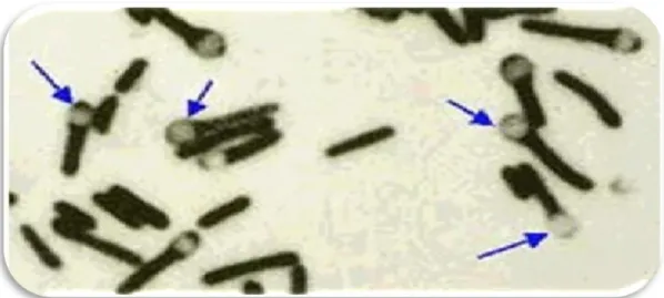 Figure 6 : Spore bactérienne [6] 