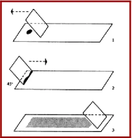 Figure 9: Frottis médullaire  [52] 