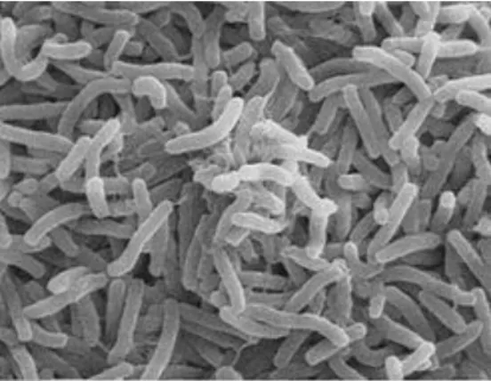 Figure 5 : photographie de la population de V.cholerae vu  