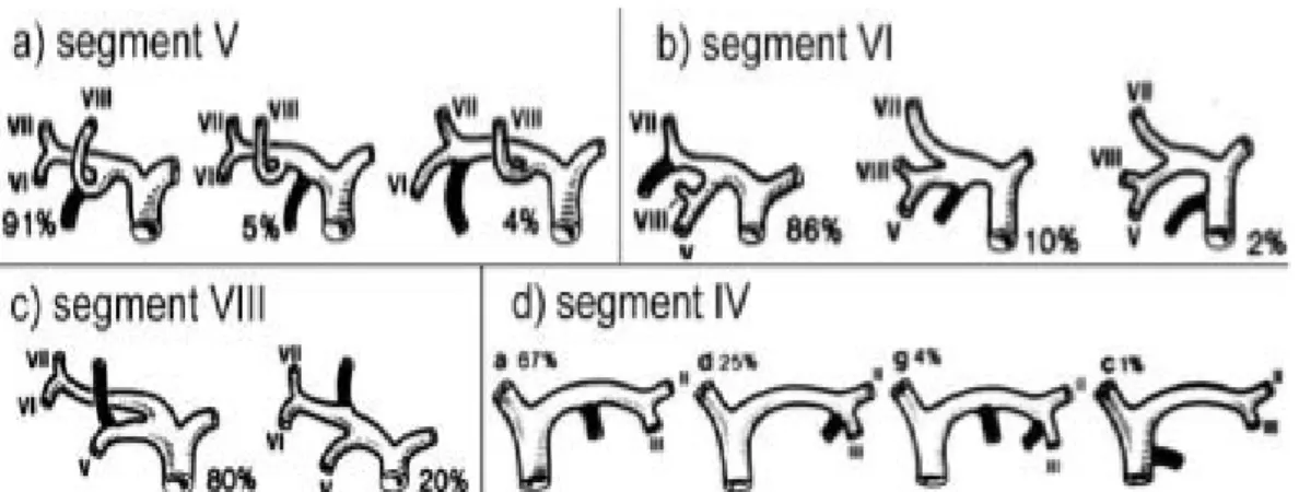 Figure  4:   Représentation   schématique   des   variations   d’abouchement   des   voies biliaires intrahépatiques droites (a, b, c) et gauches (d).