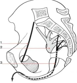 Fig. 9: Nerf honteux interne. Vue endopelvienne  1. Nerf obturateur. 2. Nerf sciatique.3