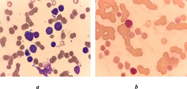 Figure 1 : a : Images des blastes colorées au MGG et observées à l’objectif×100. 