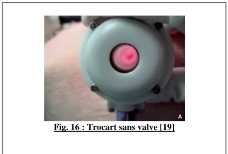 Fig. 16 : Trocart sans valve [19] 