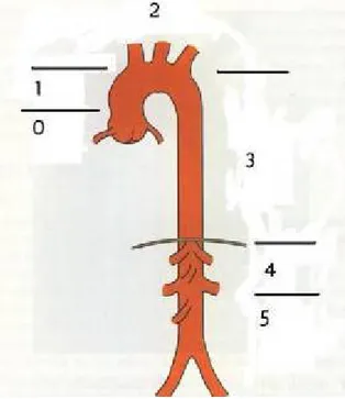 Figure 1: Schéma illustrant les différents segments de l’aorte(39) 