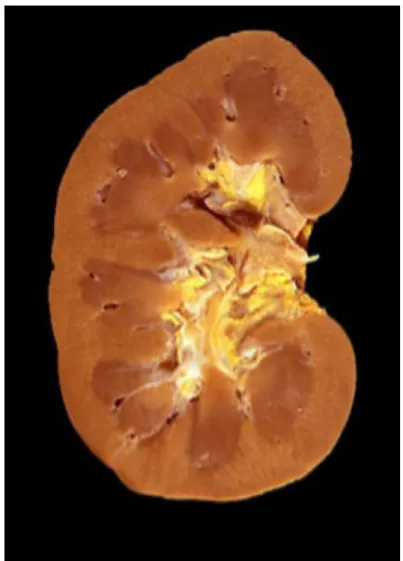 Figure 6 : coupe longitudinale d’un rein droit montrant la forme du rein humain 