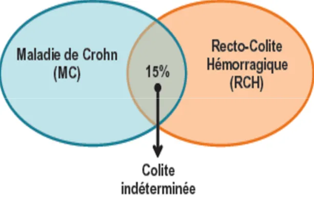 Figure 10: Répartition des maladies inflammatoires chroniques intestinales. 
