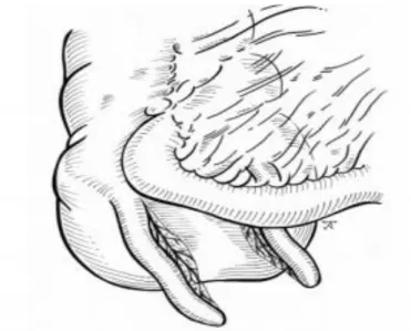 Figure 8:  DA de type B1 (bird type)  