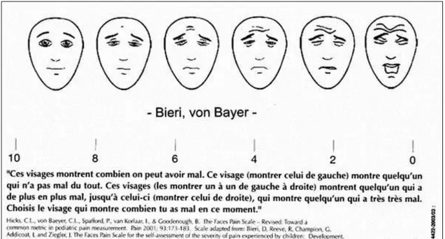 Figure 4 : Echelles de visages (FPS-R) Face Pain Scale  de 0 à 1 : Simple inconfort :   Pas de traitement 