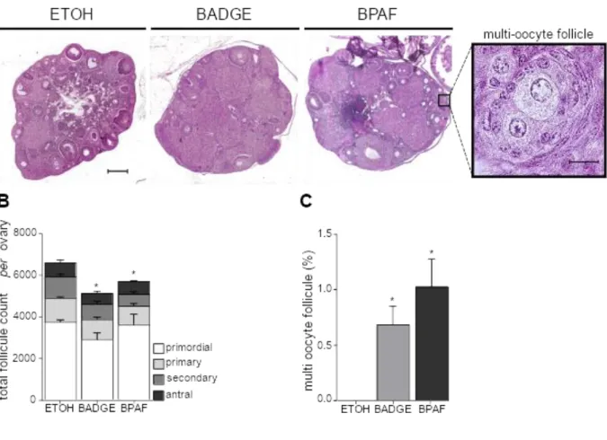 Figure 1: bisphenols fetal exposure impairs follicle number and quality in adult mouse  ovaries