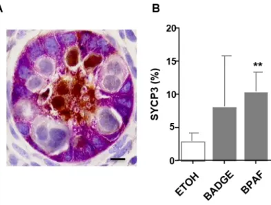 Figure 2 : Effets des bisphénols sur la différenciation des cellules germinales mâles à 14,5 jpc