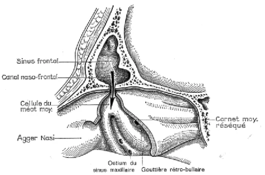 Figure 7 : coupe sagittale montrant le sinus frontal (1) 