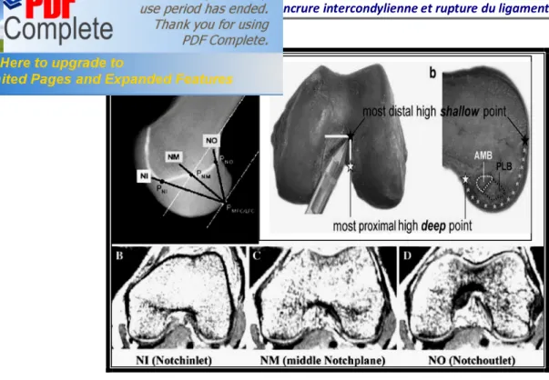 Figure 2:images IRM montrant les 3 plans de l’EIC. 12