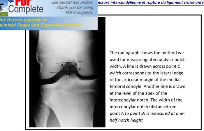 Figure 12 montrant les mensurations de la largeur de l’EIC et de la largeur fémorale. 23   The radiograph shows the method we 